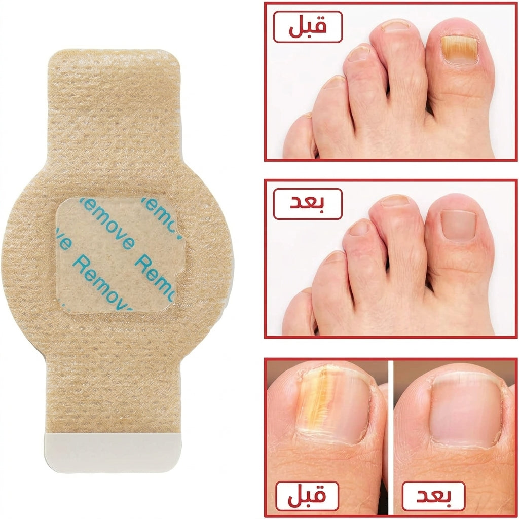 NailRestore™ – Patch Réparateur Intensif pour Ongles Abîmés (21 Patchs)